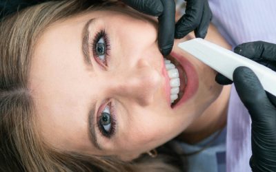 What Is Zoom Teeth Whitening On The Gold Coast?