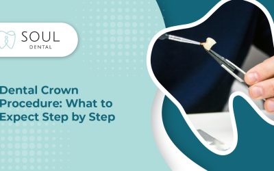 Dental Crown Procedure: What to Expect Step by Step