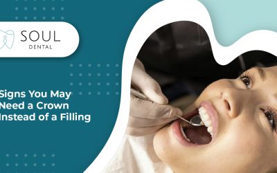 Signs You May Need a Crown Instead of a Filling