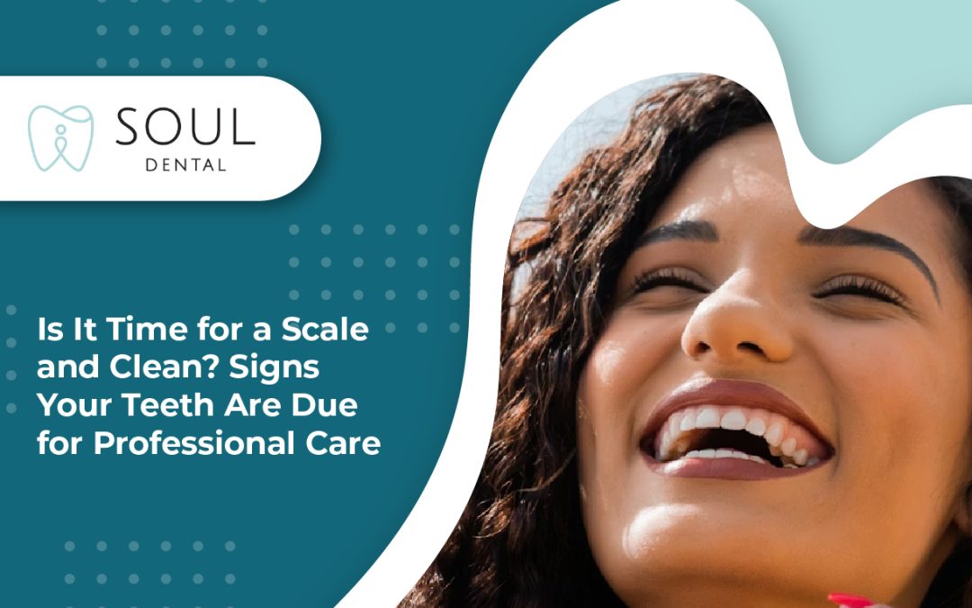 Is It Time for a Scale and Clean? Signs Your Teeth Are Due for Professional Care