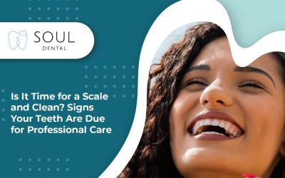 Is It Time for a Scale and Clean? Signs Your Teeth Are Due for Professional Care