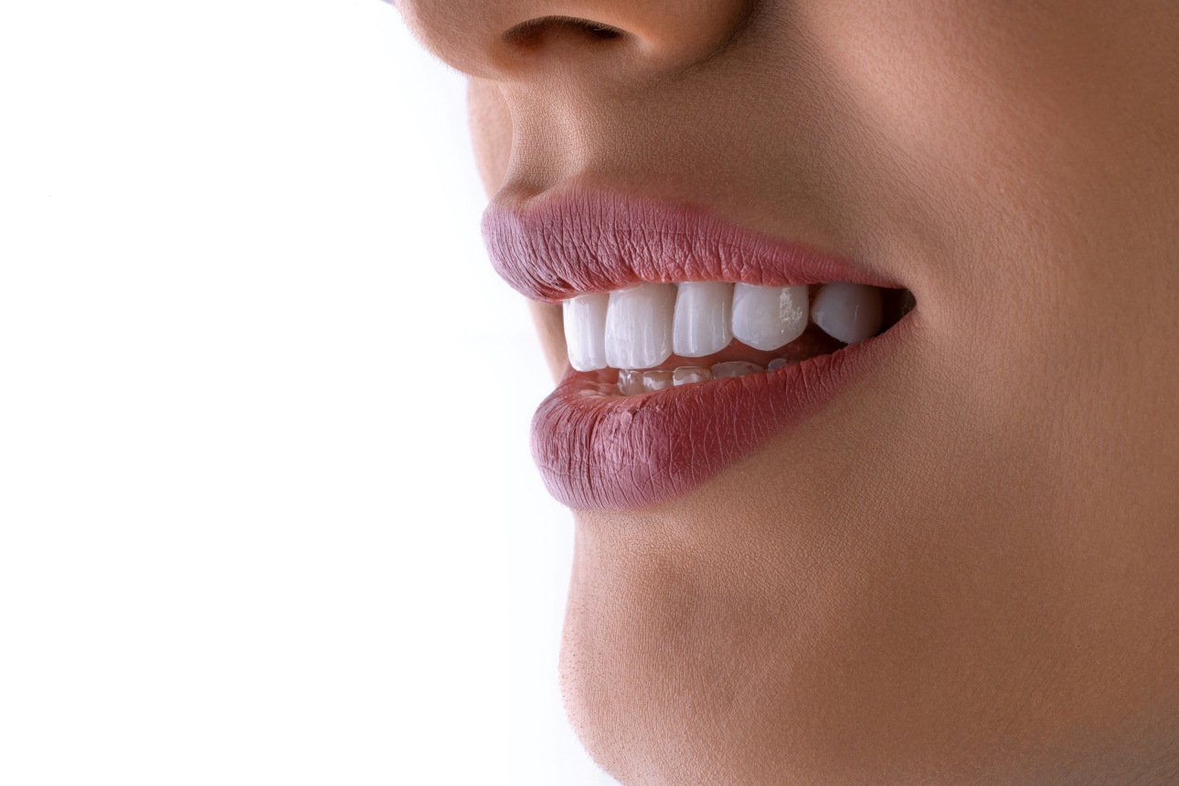 Veneers Gold Coast Soul Dental