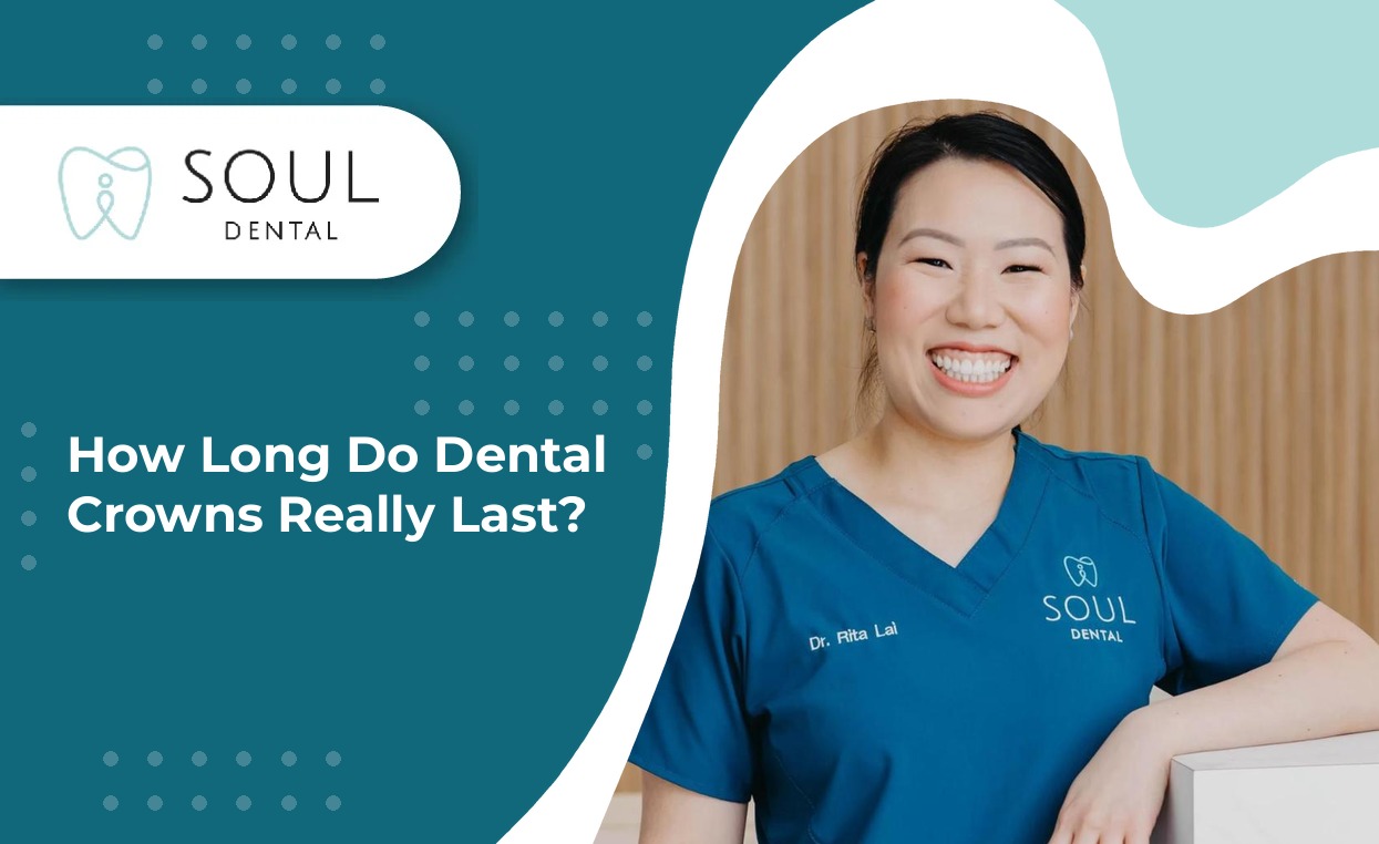 how-long-do-dental-crowns-last